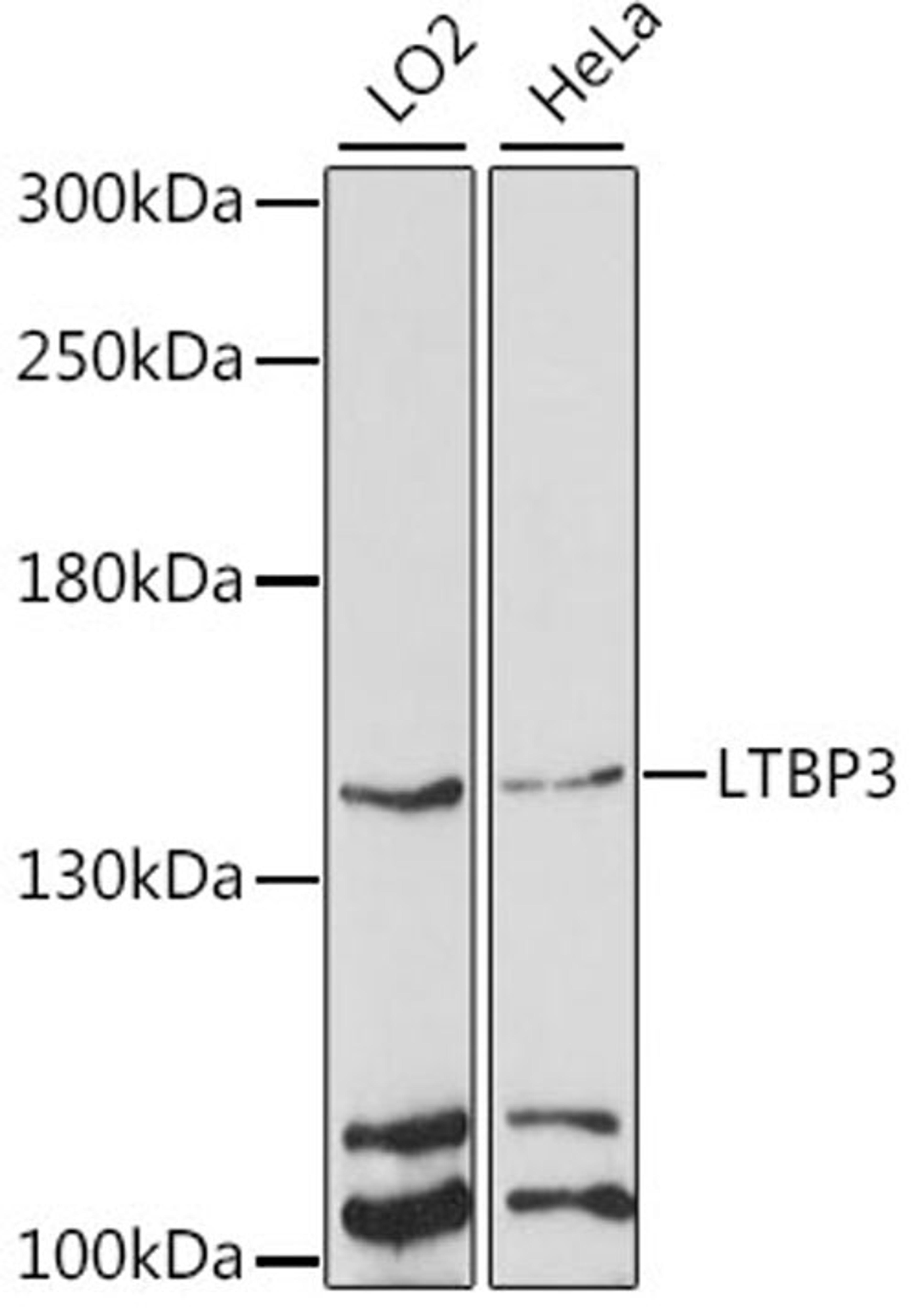 Western blot - LTBP3 antibody (A15687)