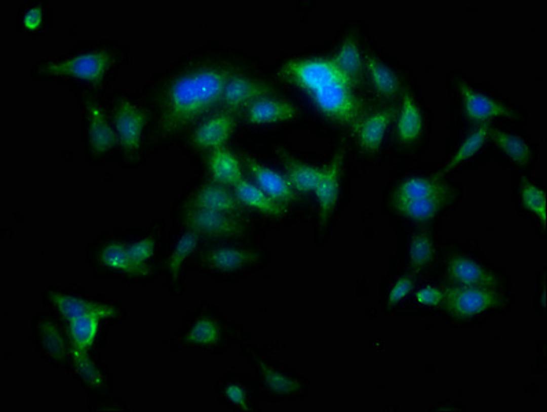 Immunofluorescence staining of HepG2 cells with CSB-PA00465A0Rb at 1:100, counter-stained with DAPI. The cells were fixed in 4% formaldehyde, permeabilized using 0.2% Triton X-100 and blocked in 10% normal Goat Serum. The cells were then incubated with the antibody overnight at 4°C. The secondary antibody was Alexa Fluor 488-congugated AffiniPure Goat Anti-Rabbit IgG(H+L).