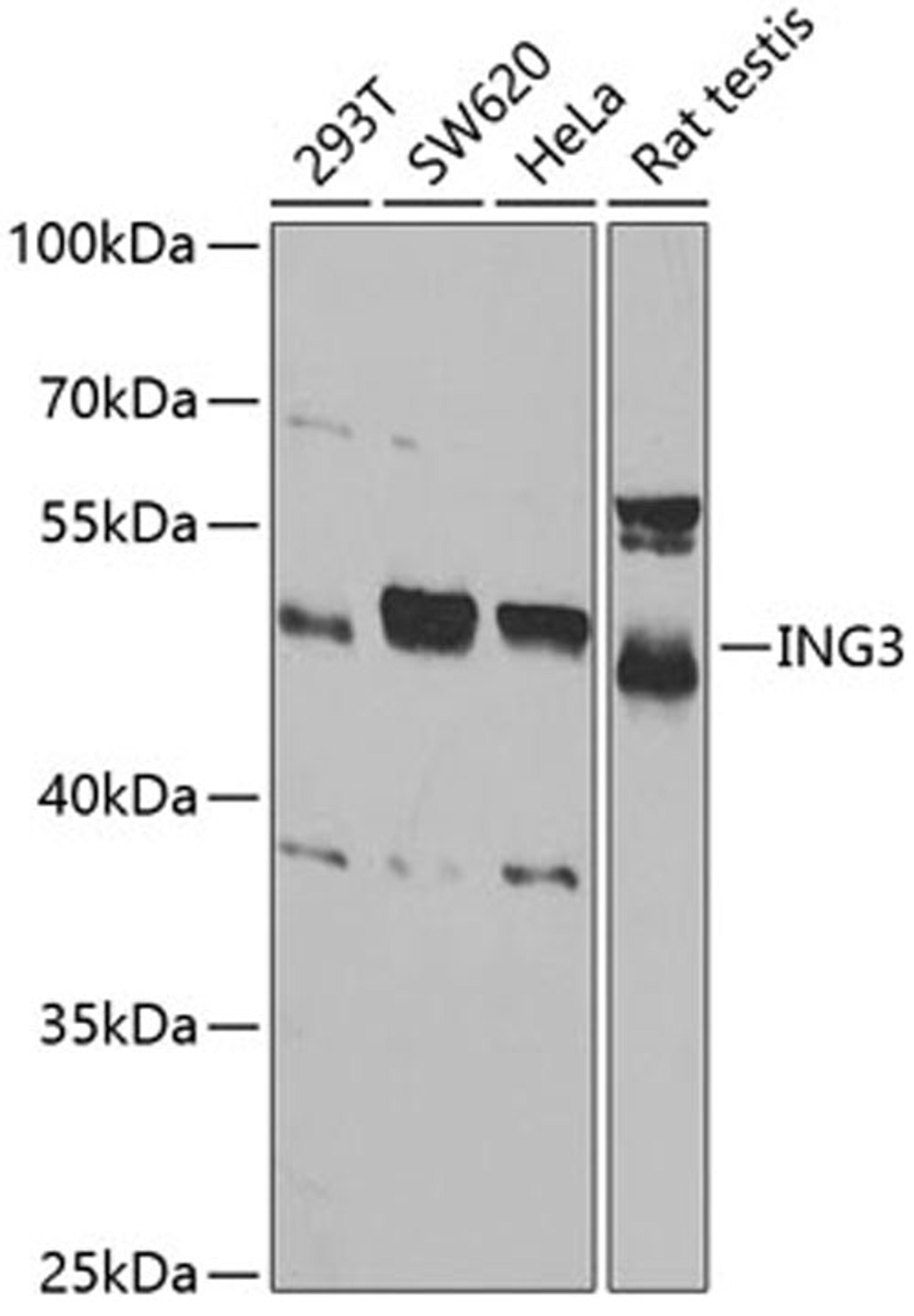 Western blot - ING3 antibody (A5832)