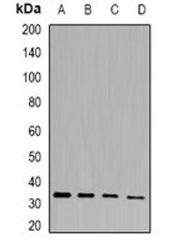 Western blot analysis of mouse heart (Lane1), mouse skin (Lane2), rat liver (Lane3), rat kidney (Lane4) whole cell lysates using PHYHD1 antibody