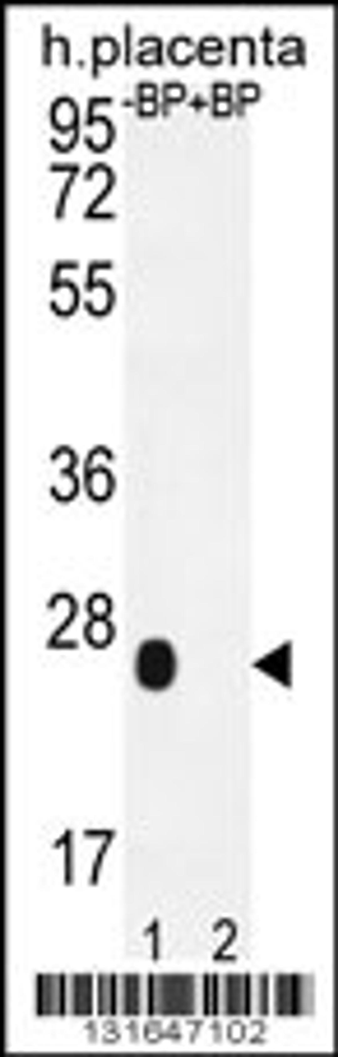 Western blot analysis of OR2J3 Antibody Pab pre-incubated without(lane 1) and with(lane 2) blocking peptide in human placenta tissue lysate.