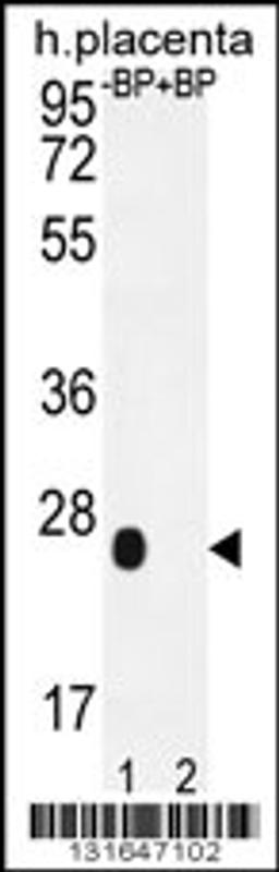 Western blot analysis of OR2J3 Antibody Pab pre-incubated without(lane 1) and with(lane 2) blocking peptide in human placenta tissue lysate.