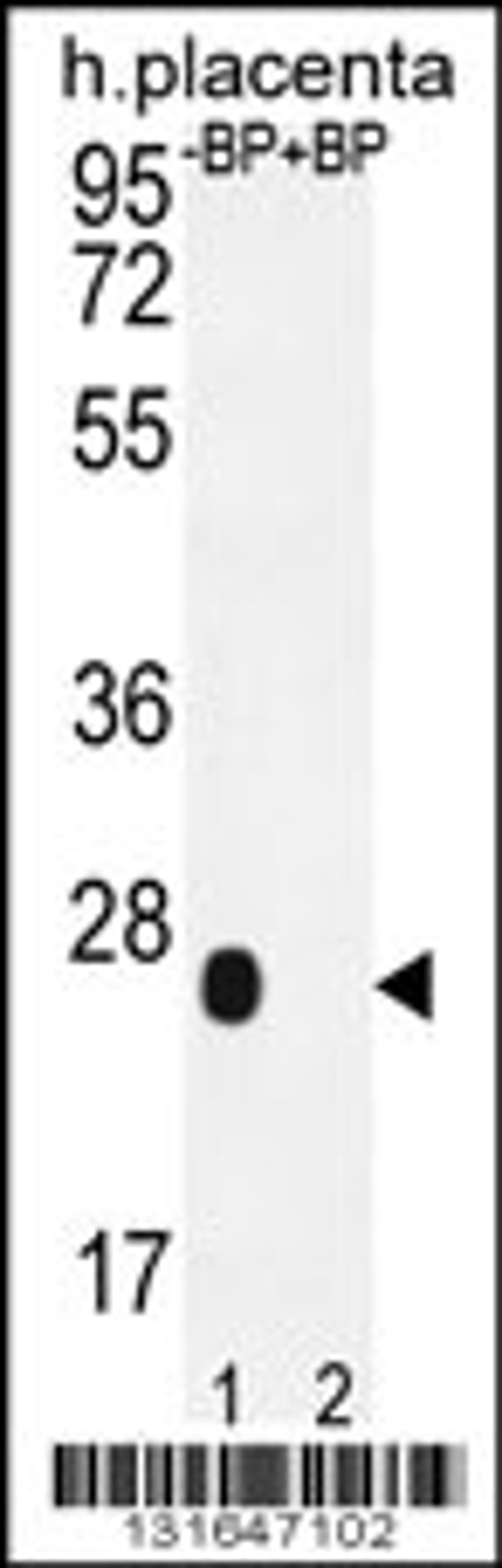 Western blot analysis of OR2J3 Antibody Pab pre-incubated without(lane 1) and with(lane 2) blocking peptide in human placenta tissue lysate.