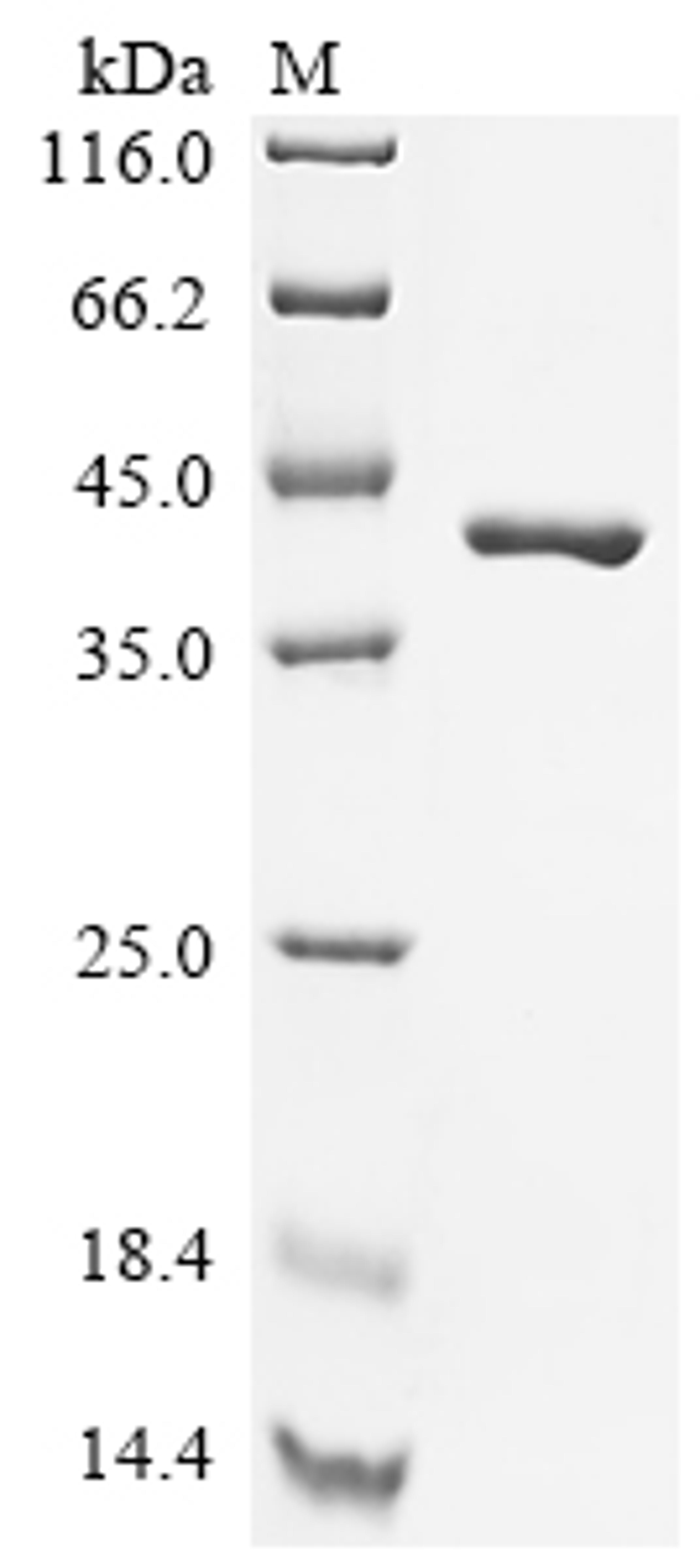 (Tris-Glycine gel) Discontinuous SDS-PAGE (reduced) with 5% enrichment gel and 15% separation gel.