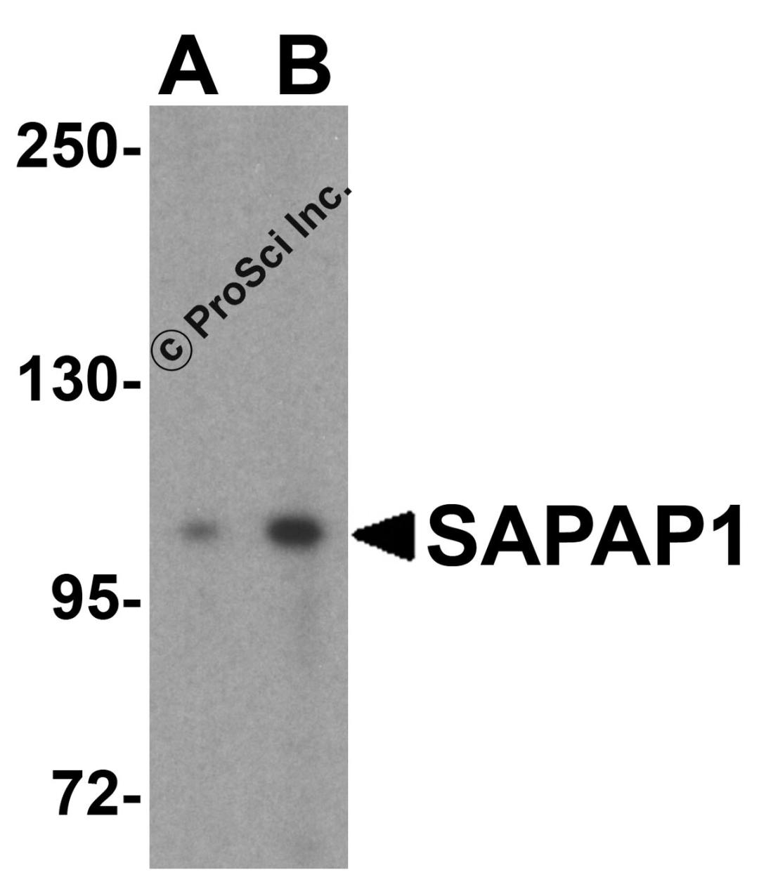 Western blot analysis of SAPAP1 in rat brain tissue lysate with SAPAP1 antibody at (A) 0.5 and (B) 1 μg/mL.
