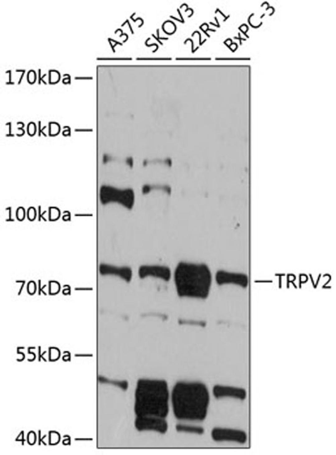 Western blot - TRPV2 antibody (A12367)