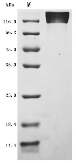 (Tris-Glycine gel) Discontinuous SDS-PAGE (reduced) with 5% enrichment gel and 15% separation gel.