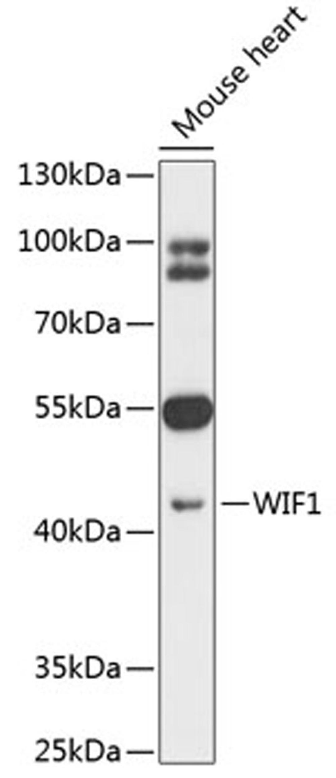 Western blot - WIF1 antibody (A12969)