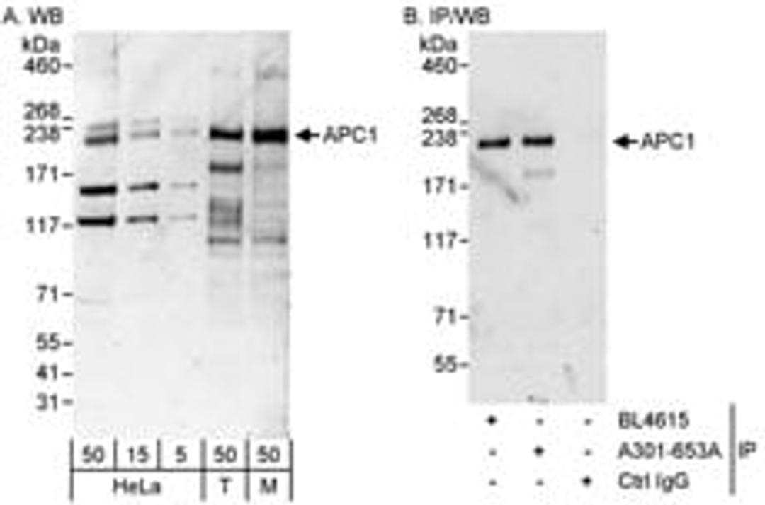 Detection of human and mouse APC1 by western blot (h&m) and immunoprecipitation (h).