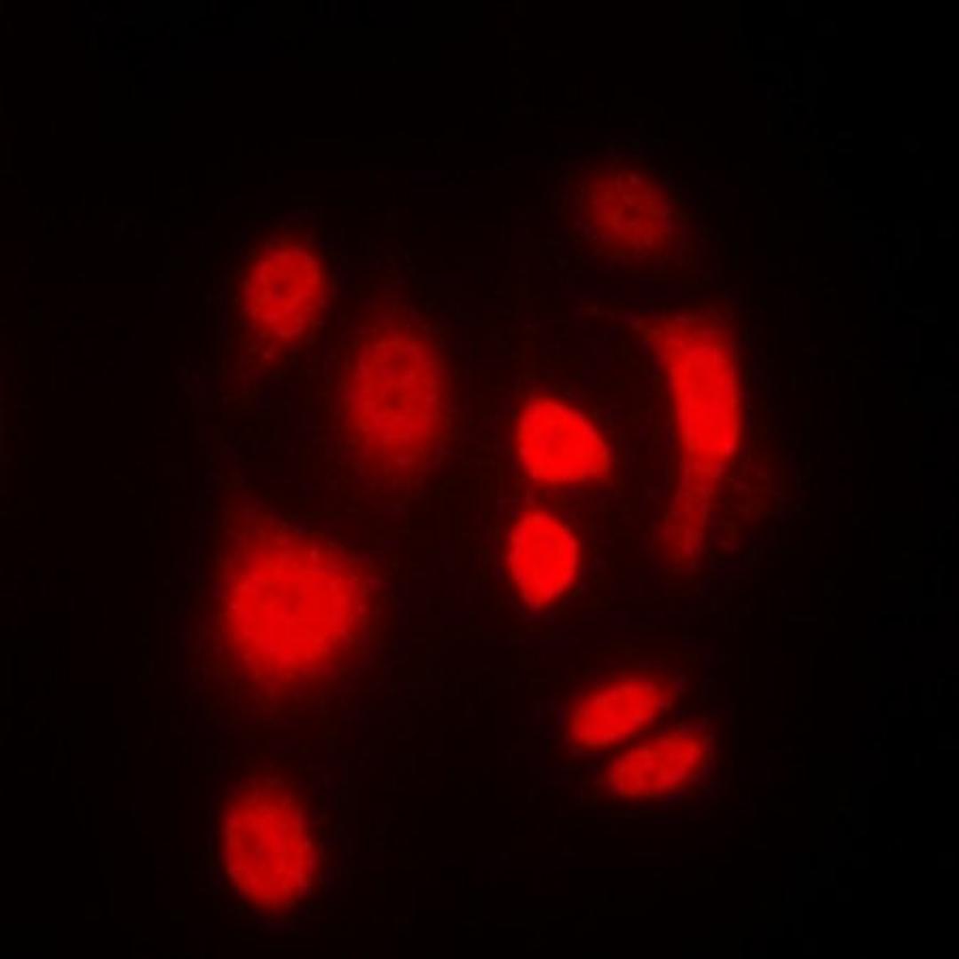 Immunofluorescense analysis of HeLa cells using SGK1/2 (phospho-T256/253) antibody