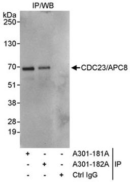 Detection of human CDC23/APC8 by western blot of immunoprecipitates.