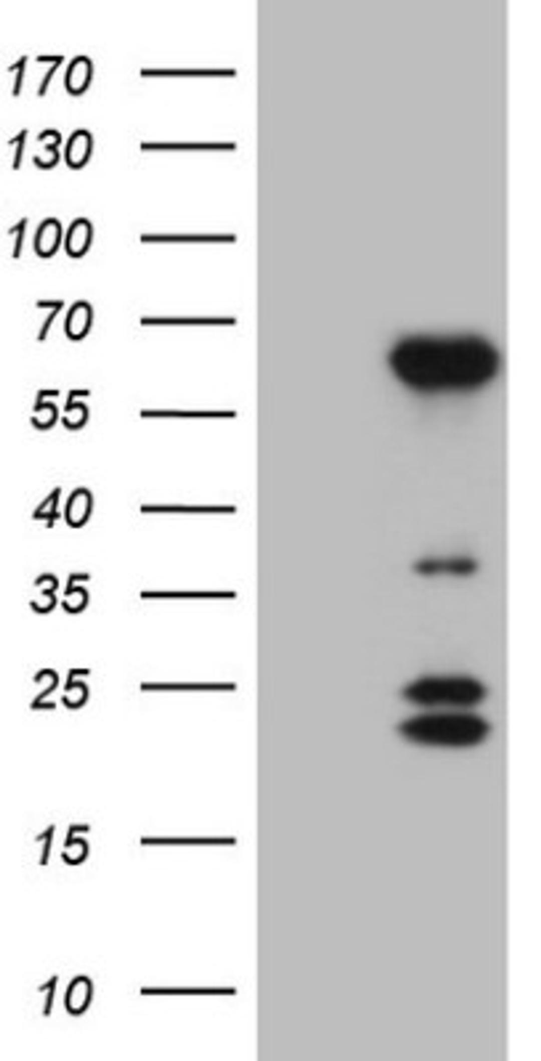 Western Blot: BTBD10 Antibody (7D3) [NBP2-46584] - Analysis of HEK293T cells were transfected with the pCMV6-ENTRY control (Left lane) or pCMV6-ENTRY BTBD10.