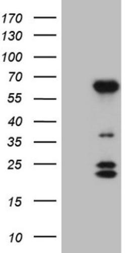 Western Blot: BTBD10 Antibody (7D3) [NBP2-46584] - Analysis of HEK293T cells were transfected with the pCMV6-ENTRY control (Left lane) or pCMV6-ENTRY BTBD10.