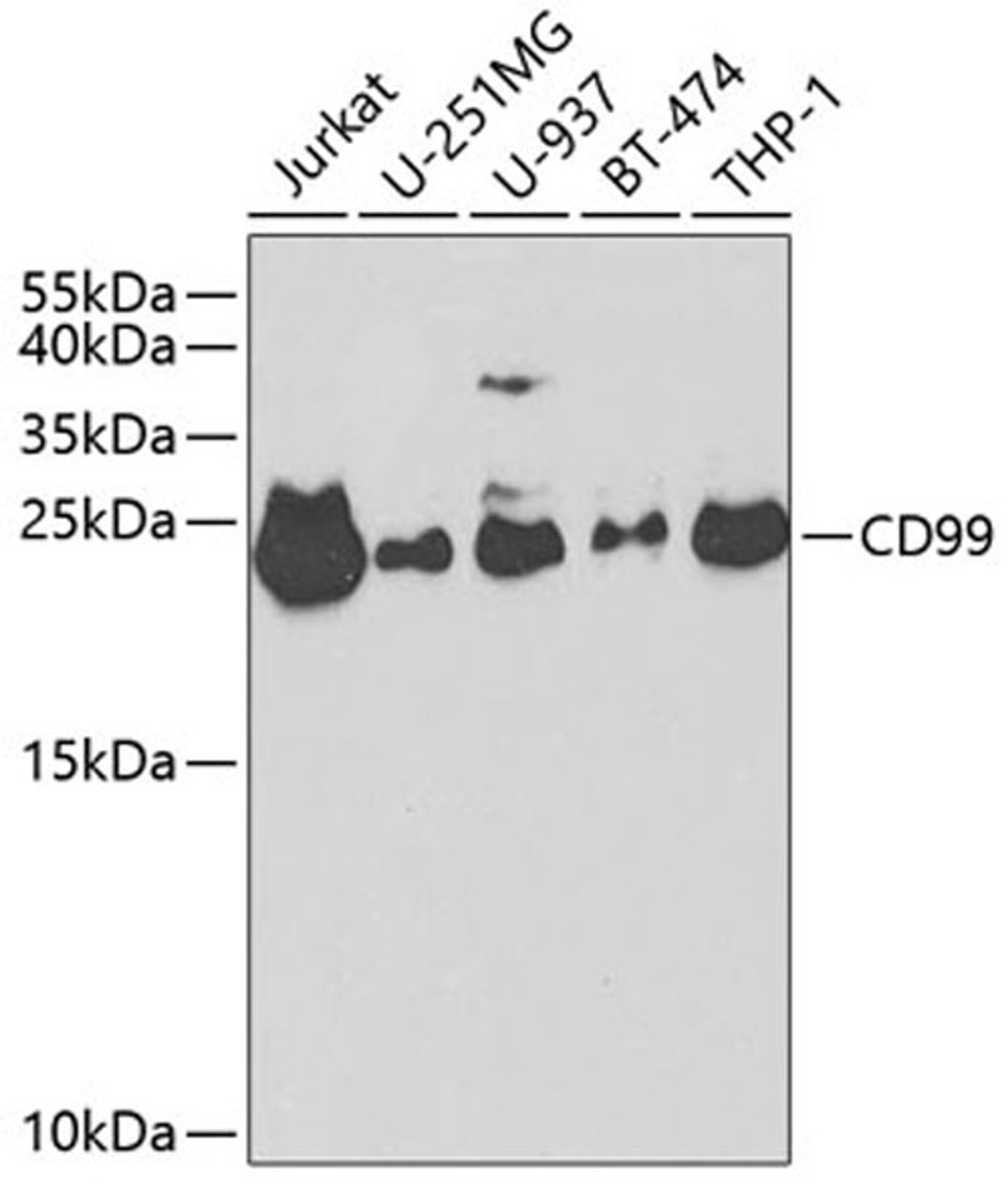 Western blot - CD99 antibody (A2028)