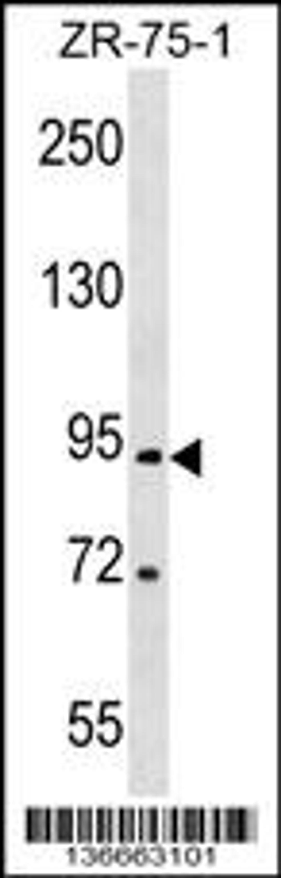 Western blot analysis in ZR-75-1 cell line lysates (35ug/lane).