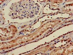 Immunohistochemistry of paraffin-embedded human kidney tissue using CSB-PA018503LA01HU at dilution of 1:100