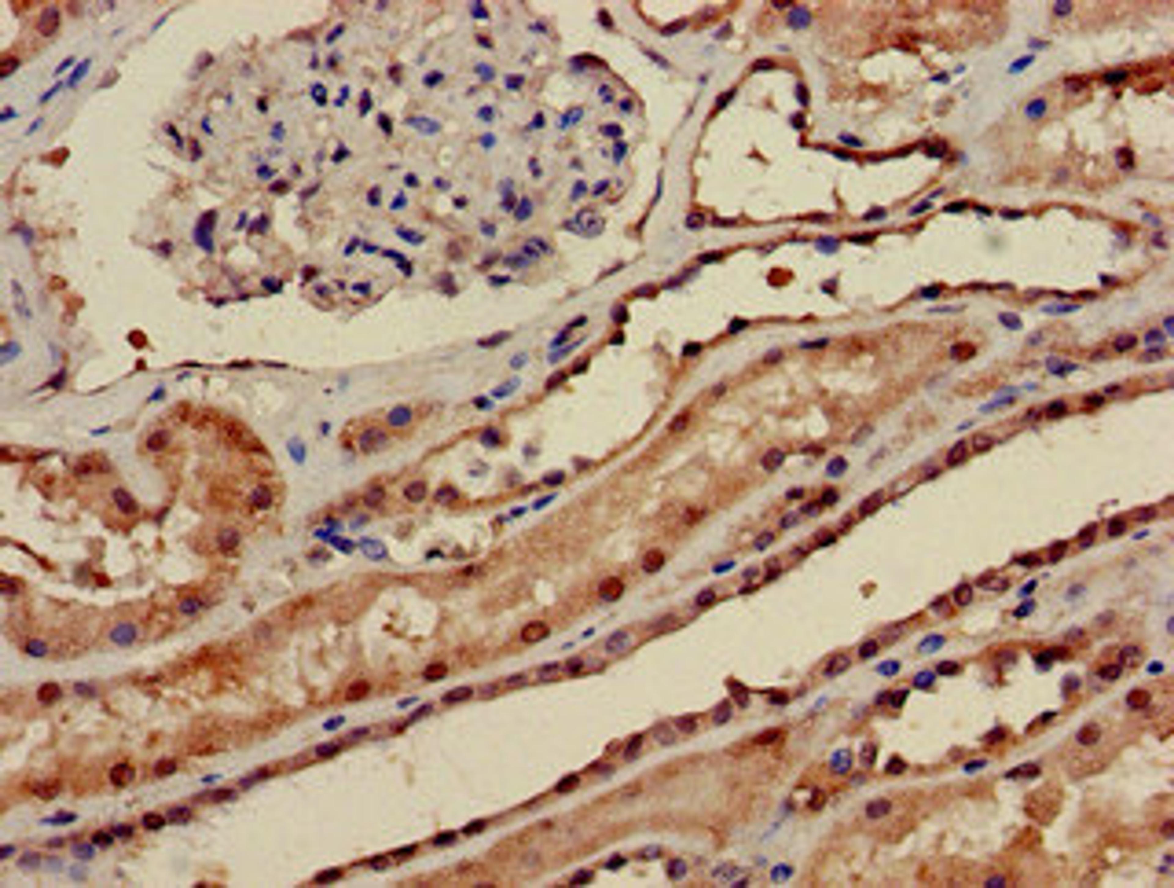 Immunohistochemistry of paraffin-embedded human kidney tissue using CSB-PA018503LA01HU at dilution of 1:100