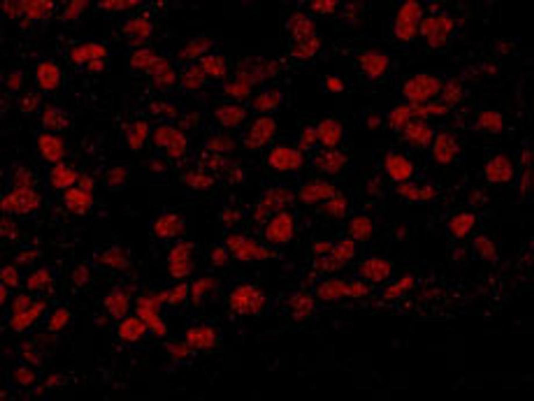 Detection of human BAF53A by immunohistochemistry.