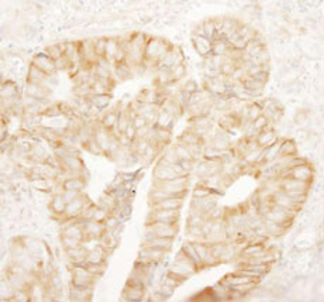 Detection of human rpL7a/SURF3 by immunohistochemistry.