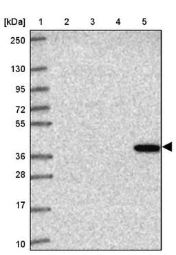 Western Blot: MAMSTR Antibody [NBP2-33843] - Lane 1: Marker [kDa] 250, 130, 95, 72, 55, 36, 28, 17, 10<br/>Lane 2: Human cell line RT-4<br/>Lane 3: Human cell line U-251MG sp<br/>Lane 4: Human plasma (IgG/HSA depleted)<br/>Lane 5: Human liver tissue