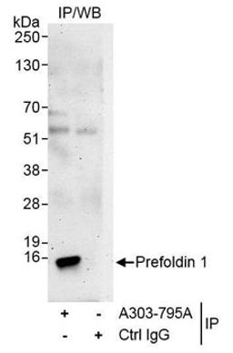 Detection of human Prefoldin 1 by western blot of immunoprecipitates.