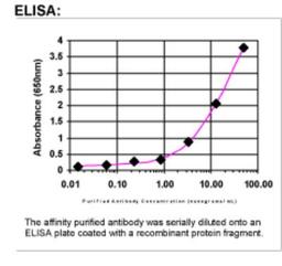 ELISA: HMGA2 Antibody [25810002]