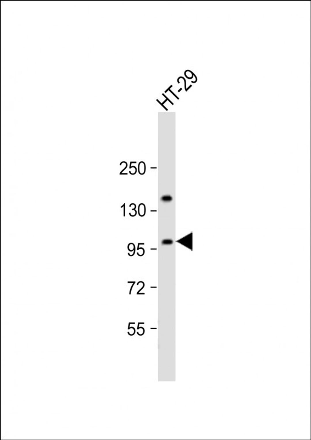 Western Blot at 1:2000 dilution + HT-29 whole cell lysate Lysates/proteins at 20 ug per lane.