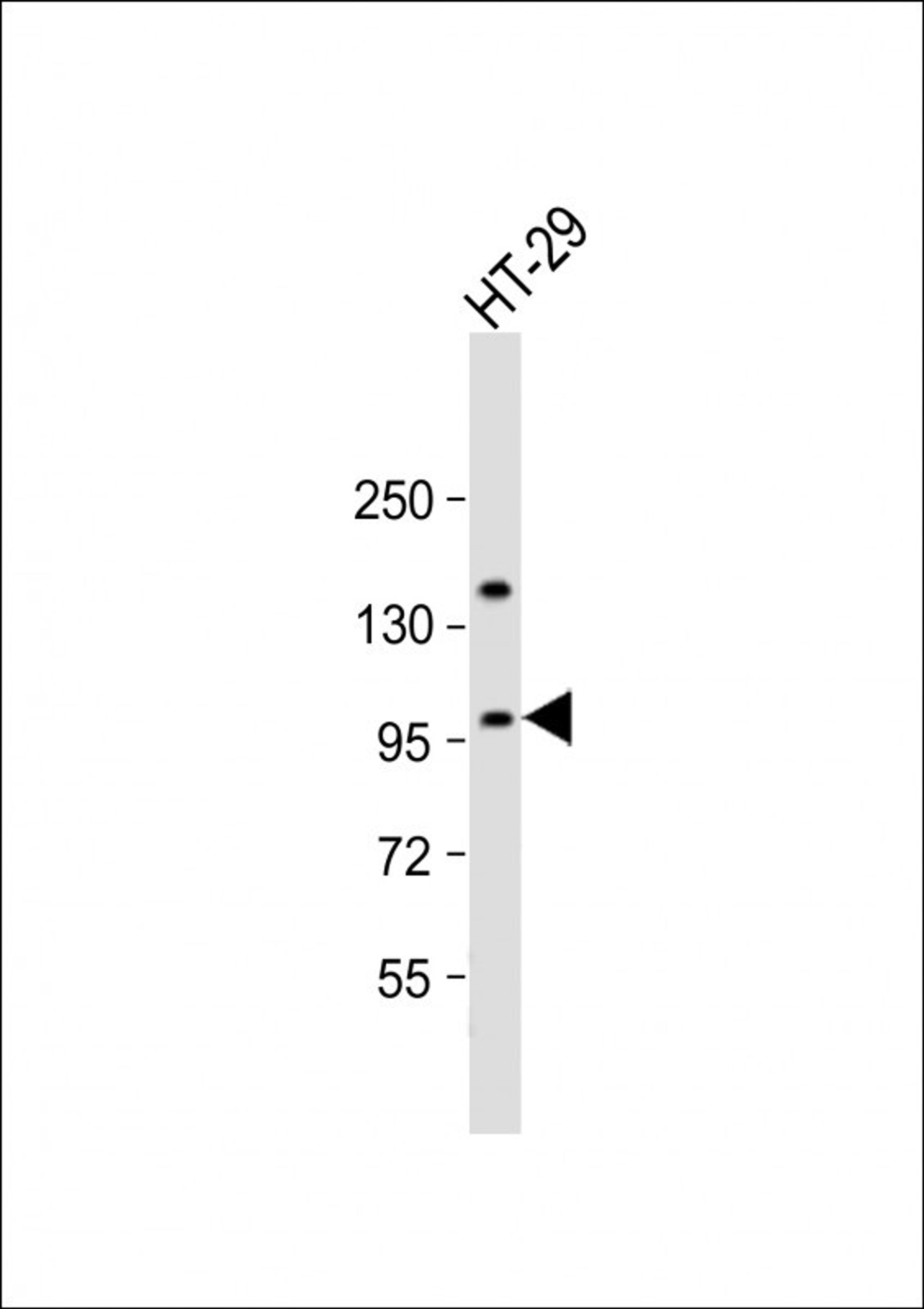 Western Blot at 1:2000 dilution + HT-29 whole cell lysate Lysates/proteins at 20 ug per lane.