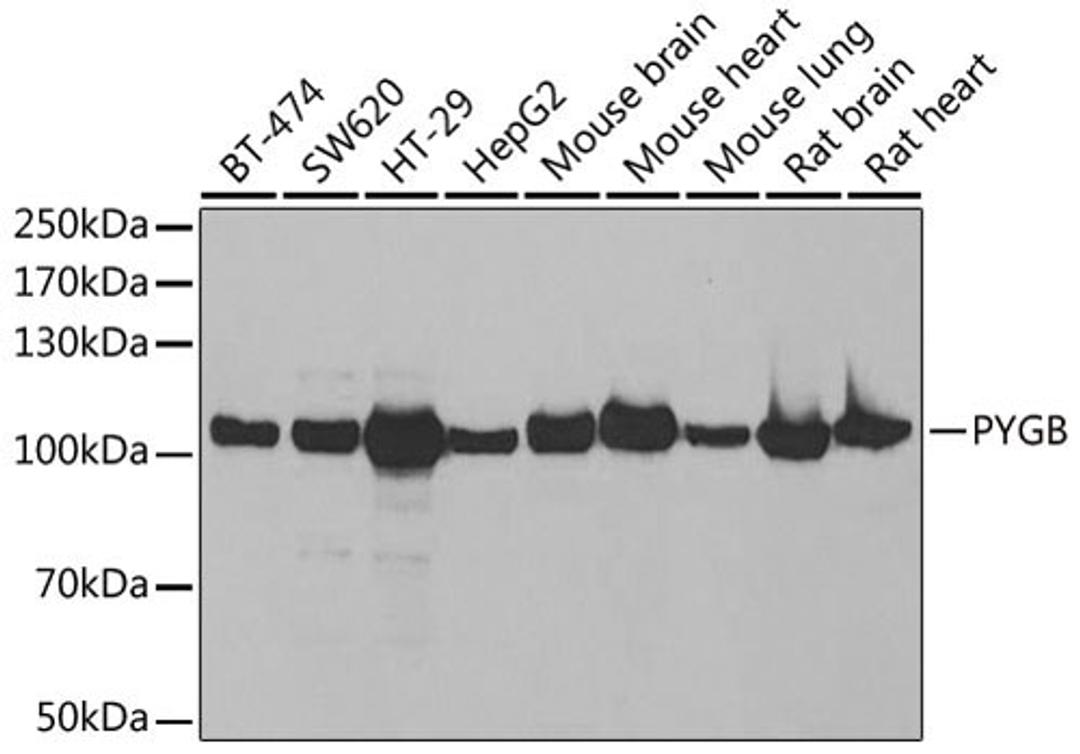 Western blot - PYGB antibody (A6402)