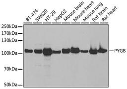 Western blot - PYGB antibody (A6402)