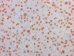 Immunohistochemical staining of mouse liver tissue using AKT3 FITC antibody (FITC)