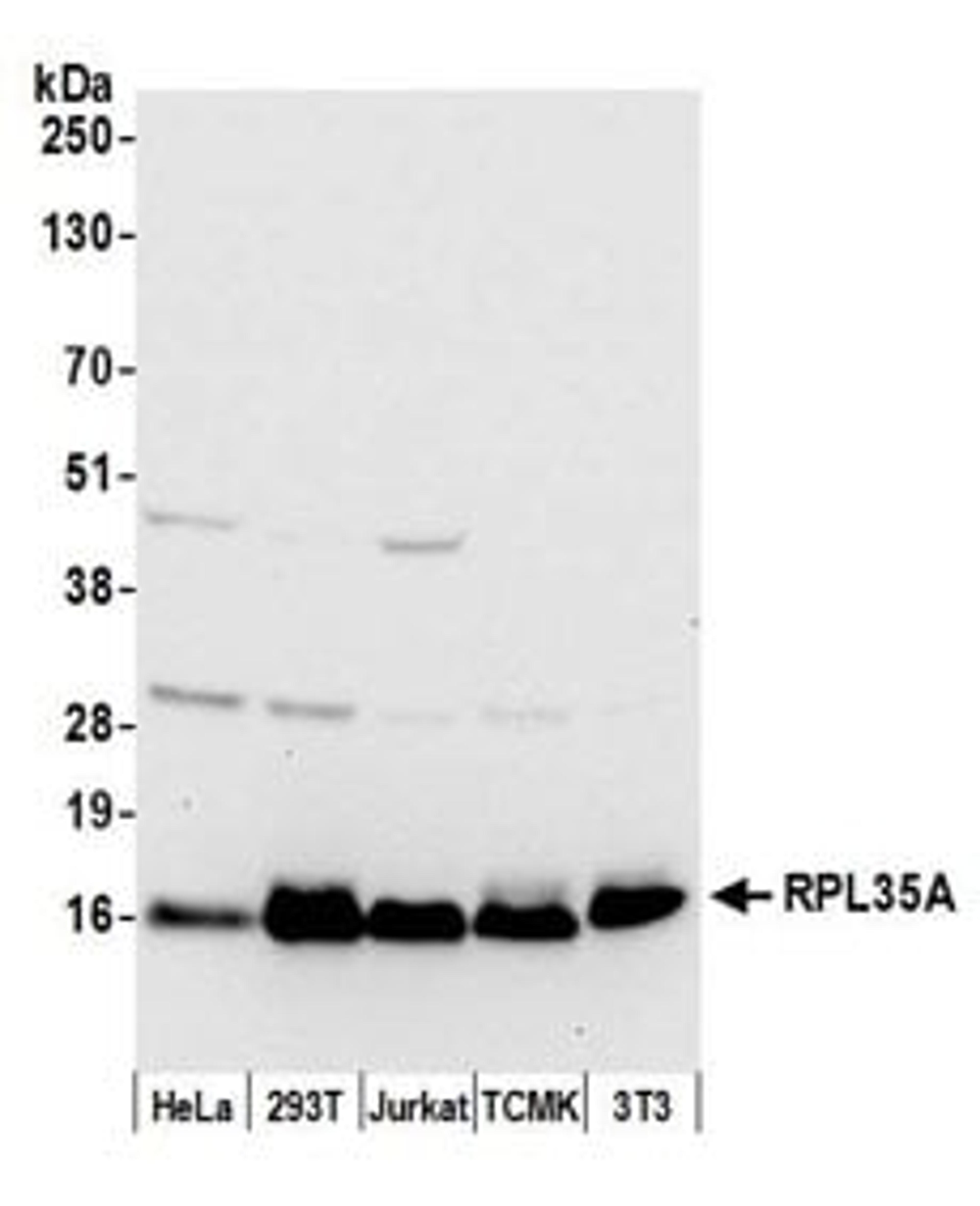 Detection of human and mouse RPL35A by western blot.