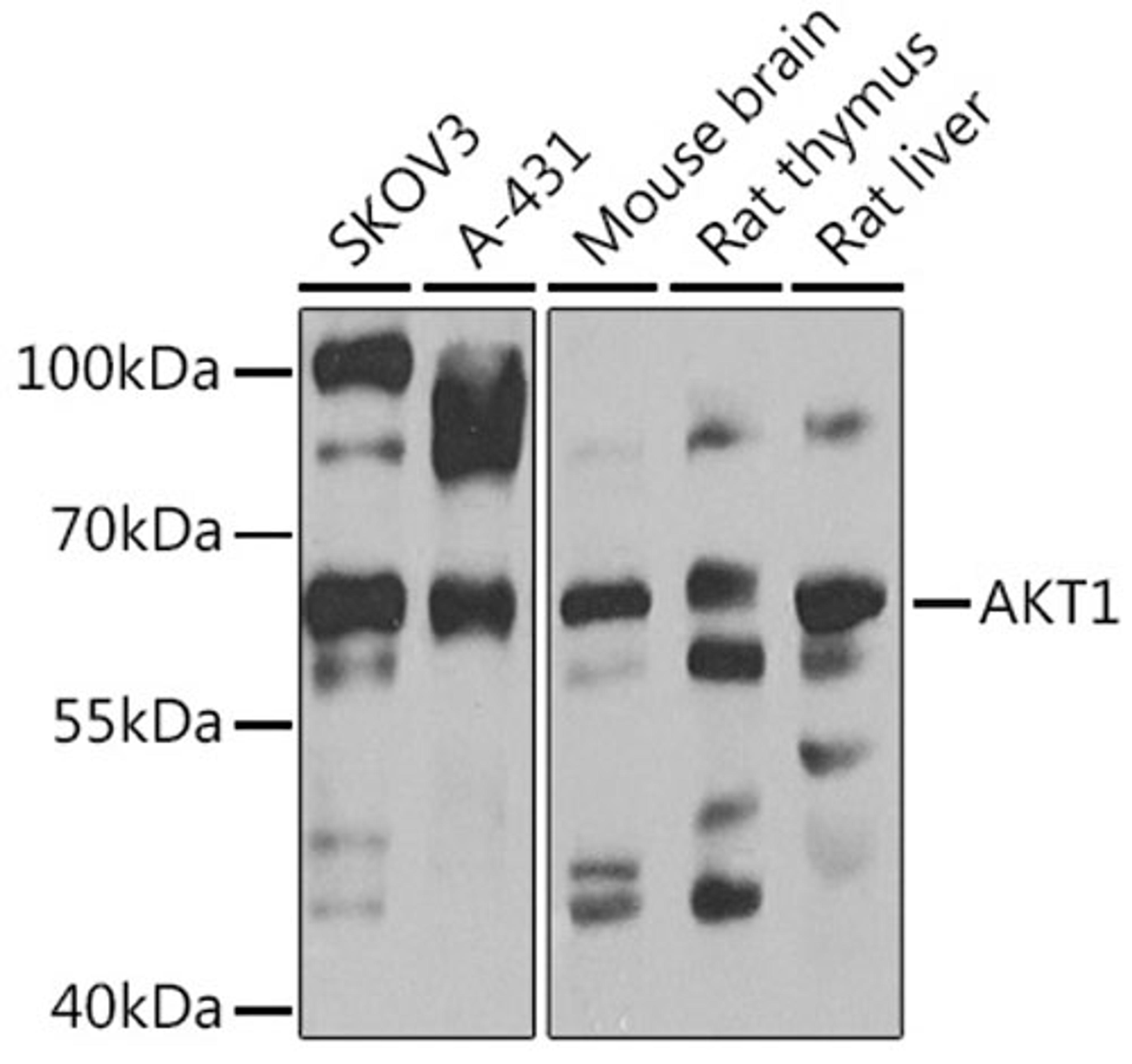 Western blot - AKT1 antibody (A11915)