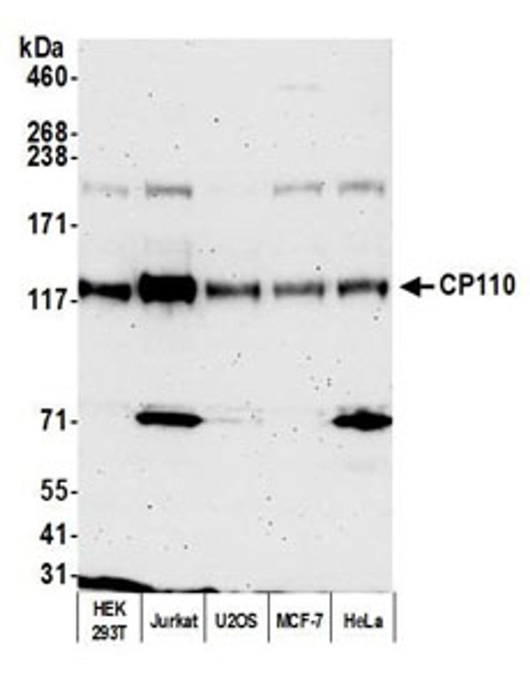 Detection of human CP110 by western blot.