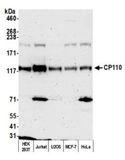 Detection of human CP110 by western blot.