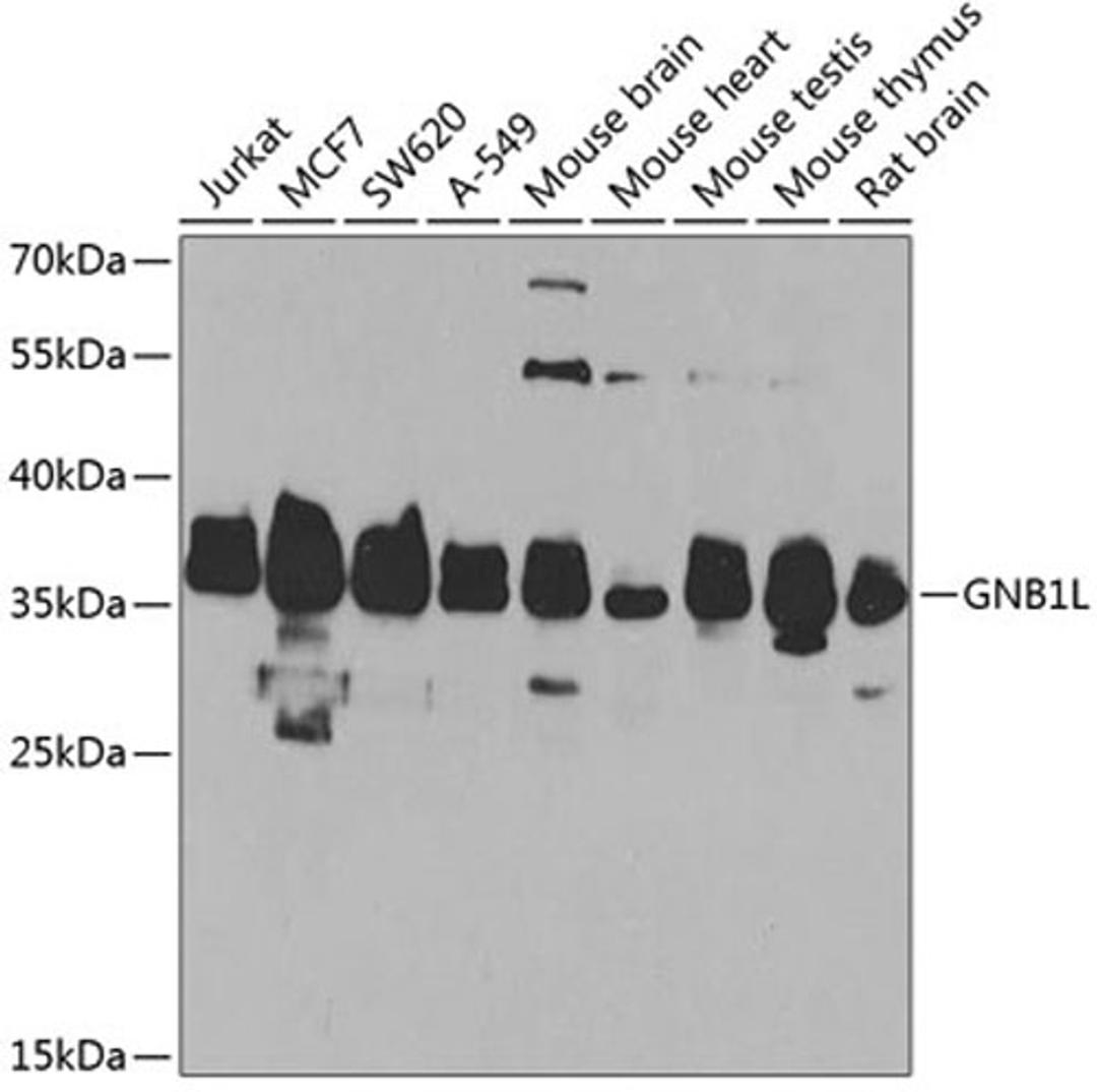 Western blot - GNB1L antibody (A7810)