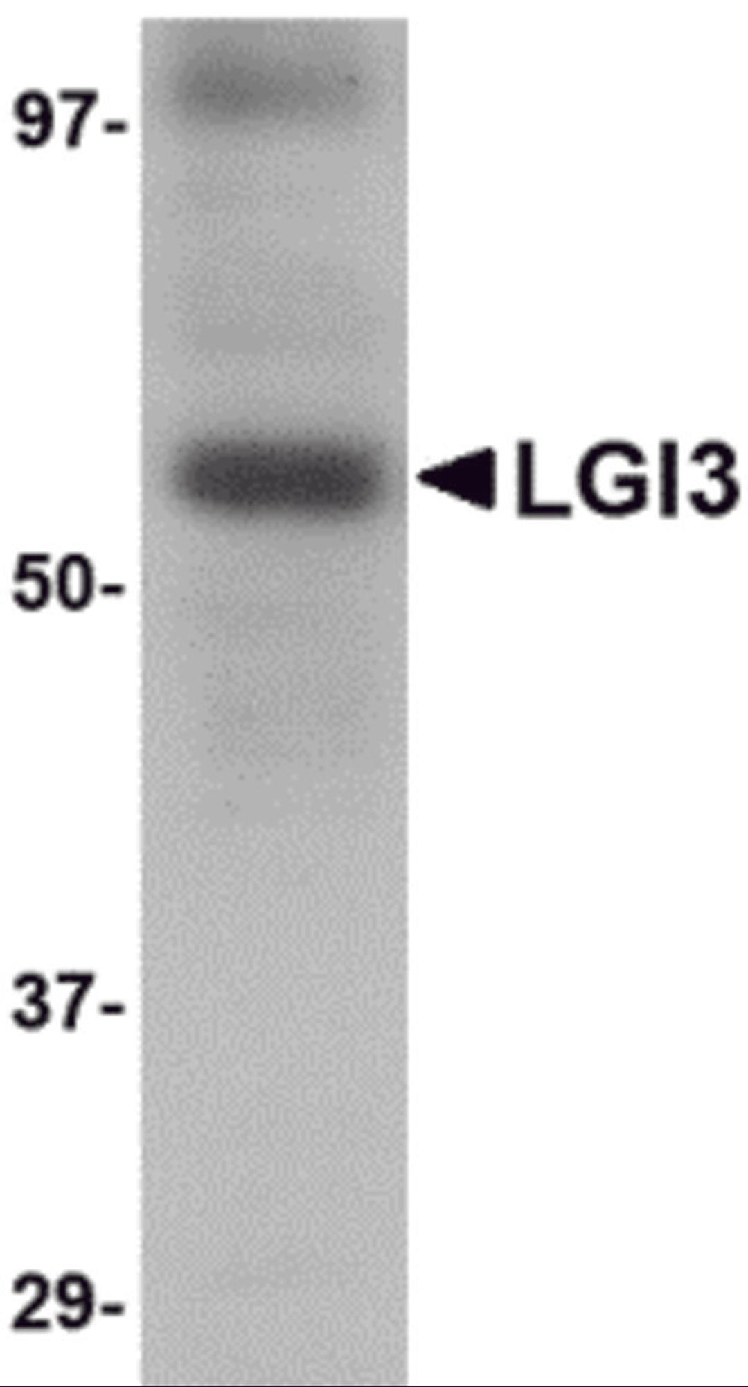 Western blot analysis of LGI3 in human brain tissue lysate with LGI3 antibody at 1 &#956;g/mL.