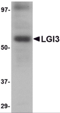 Western blot analysis of LGI3 in human brain tissue lysate with LGI3 antibody at 1 &#956;g/mL.