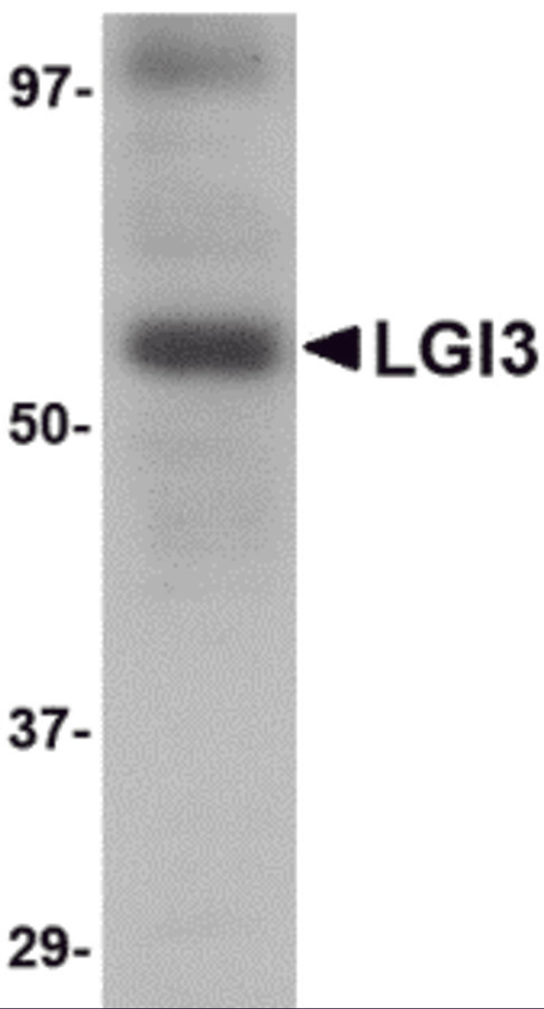 Western blot analysis of LGI3 in human brain tissue lysate with LGI3 antibody at 1 μg/mL.