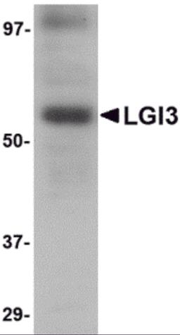 Western blot analysis of LGI3 in human brain tissue lysate with LGI3 antibody at 1 μg/mL.