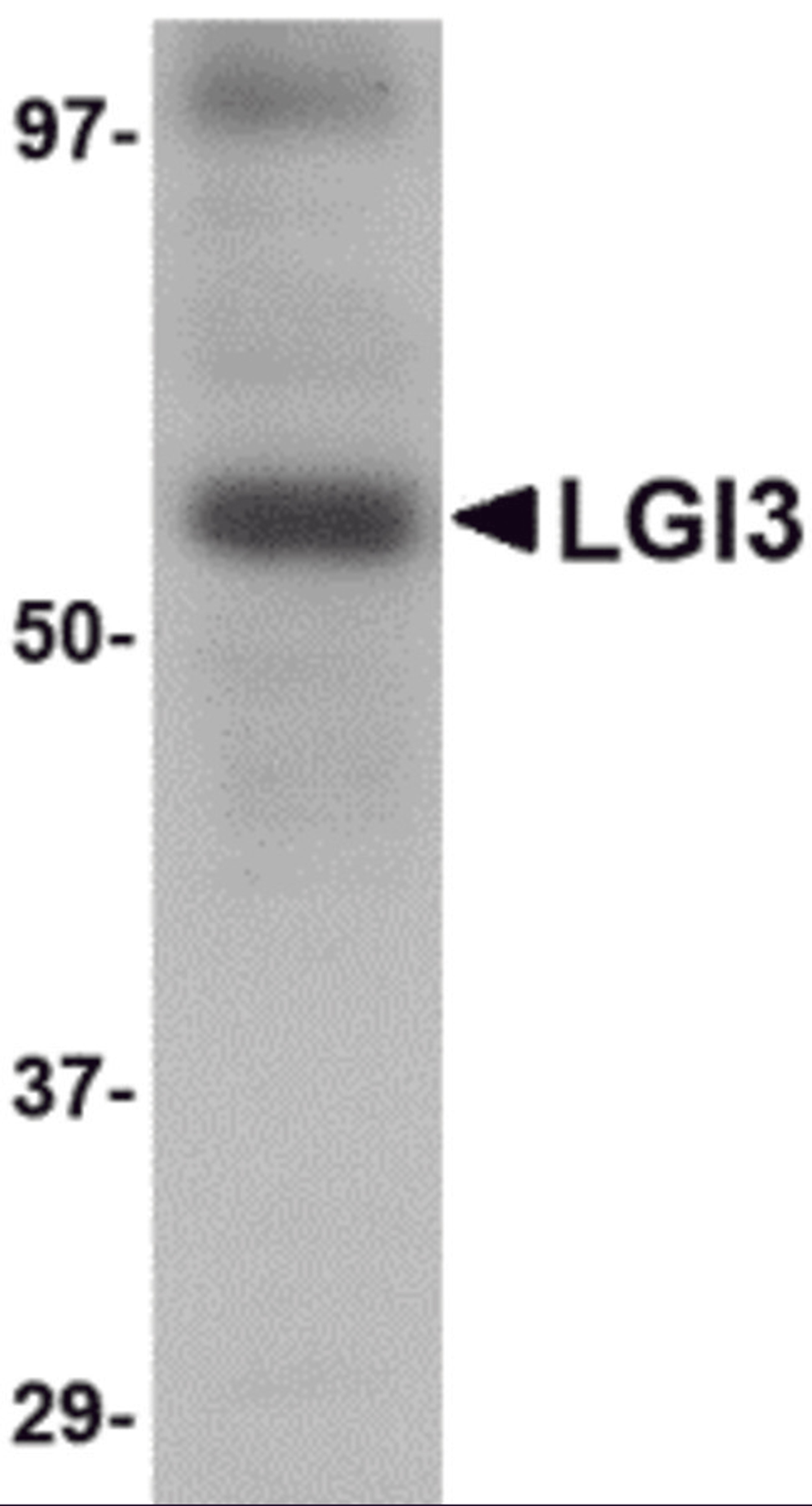 Western blot analysis of LGI3 in human brain tissue lysate with LGI3 antibody at 1 μg/mL.