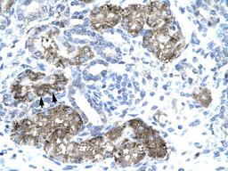 Antibody used in IHC on Human kidney.