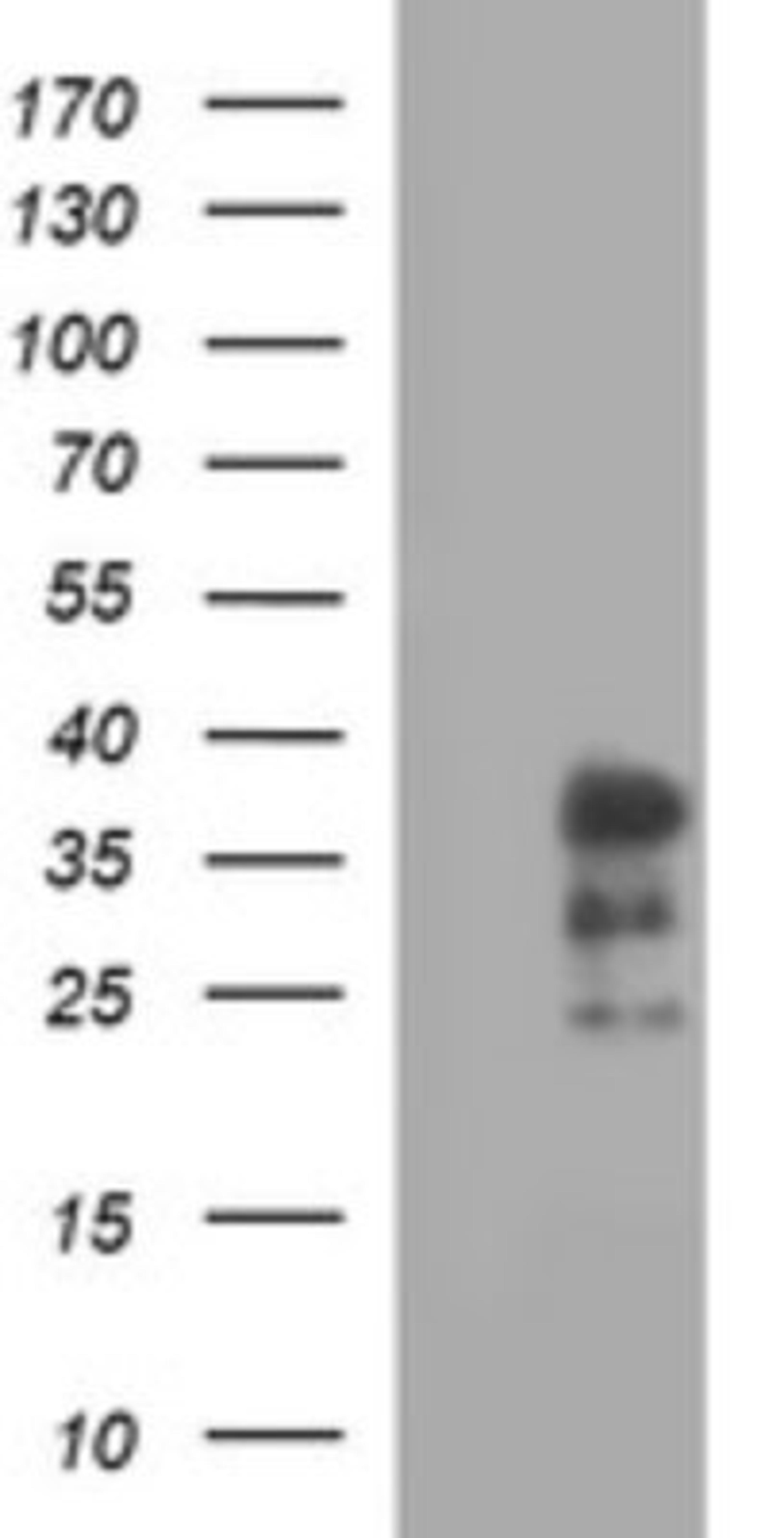 Western Blot: IL-1 alpha/IL-1F1 Antibody (2F8) [NBP2-45400] - Analysis of HEK293T cells lysate (5 ug, left lane) and full length human recombinant protein of human IL-1 alpha (NP_000566) produced in Analysis of HEK293T cell (5 ug, right lane).