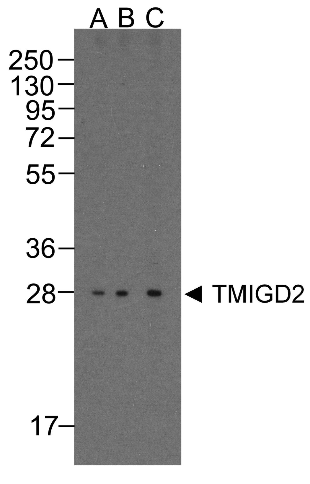 Western blot analysis of TMIGD2 in overexpressing HEK293 cells TMIGD2 antibody at 0.25, 0.5, and 1 μg/ml