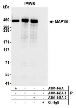 Detection of human MAP1B by western blot of immunoprecipitates.