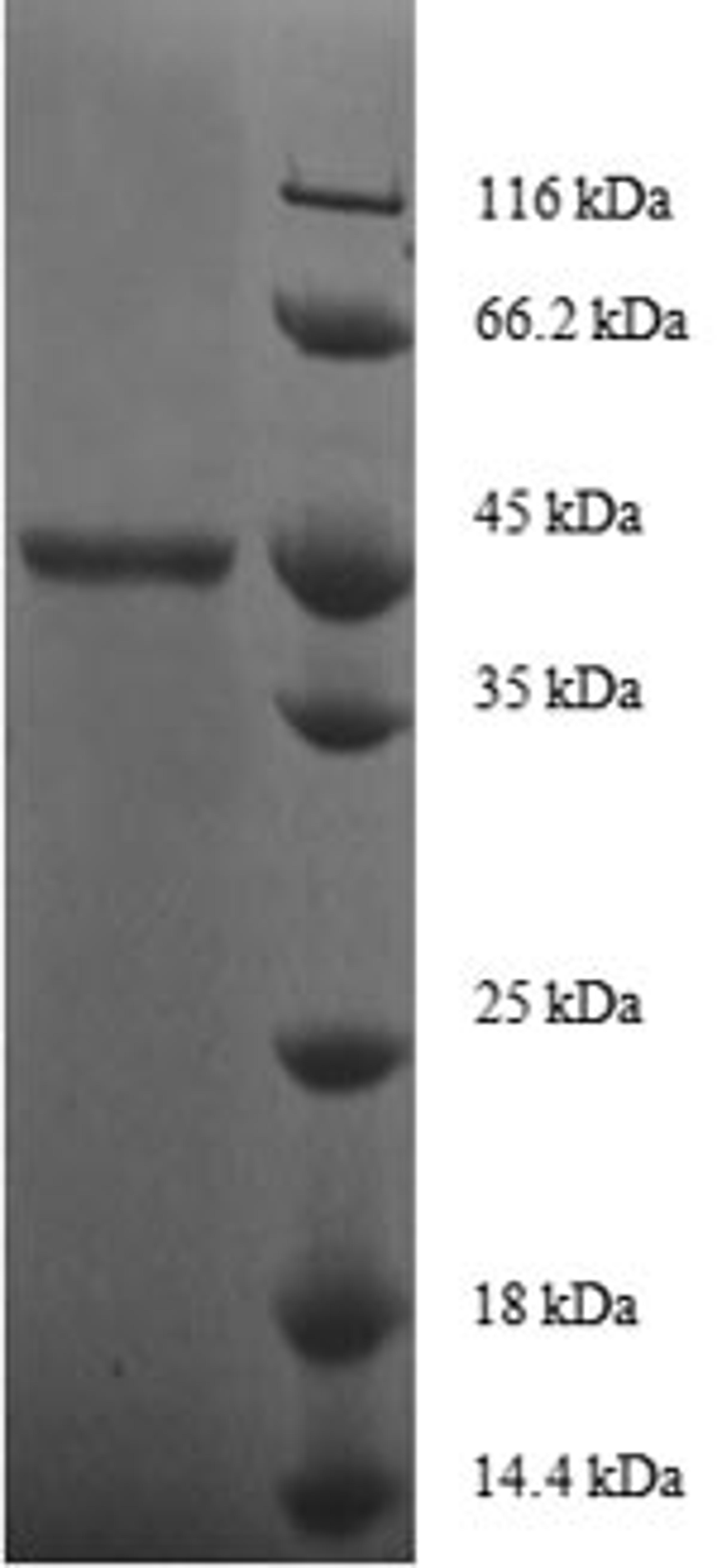 (Tris-Glycine gel) Discontinuous SDS-PAGE (reduced) with 5% enrichment gel and 15% separation gel.