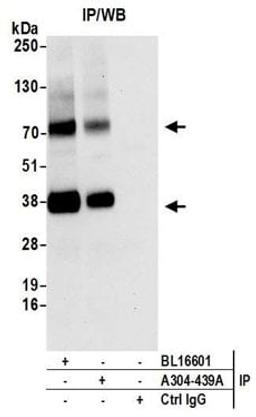 Detection of human MCT4 by western blot of immunoprecipitates.