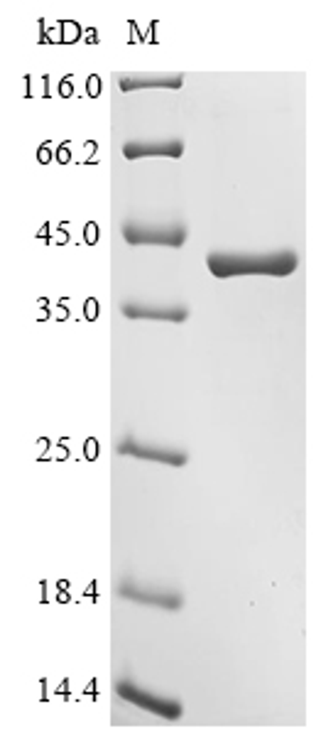 (Tris-Glycine gel) Discontinuous SDS-PAGE (reduced) with 5% enrichment gel and 15% separation gel.