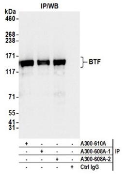 Detection of human BTF by western blot of immunoprecipitates.