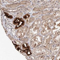 Immunohistochemistry-Paraffin: SLC12A3 Antibody [NBP1-86376] - Staining of human kidney shows strong cytoplasmic positivity in cells in tubules.